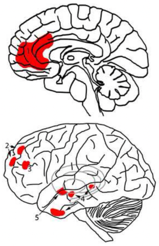 Map of the areas involved in confidence in the human